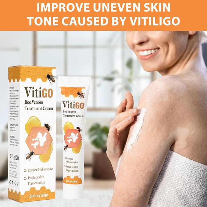 Vitiligo Bee Venom Treatment Cream, Skin Topical Cream,