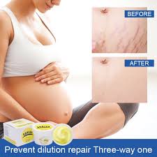 Sunisa Stretch mark and Scar Remover Cream